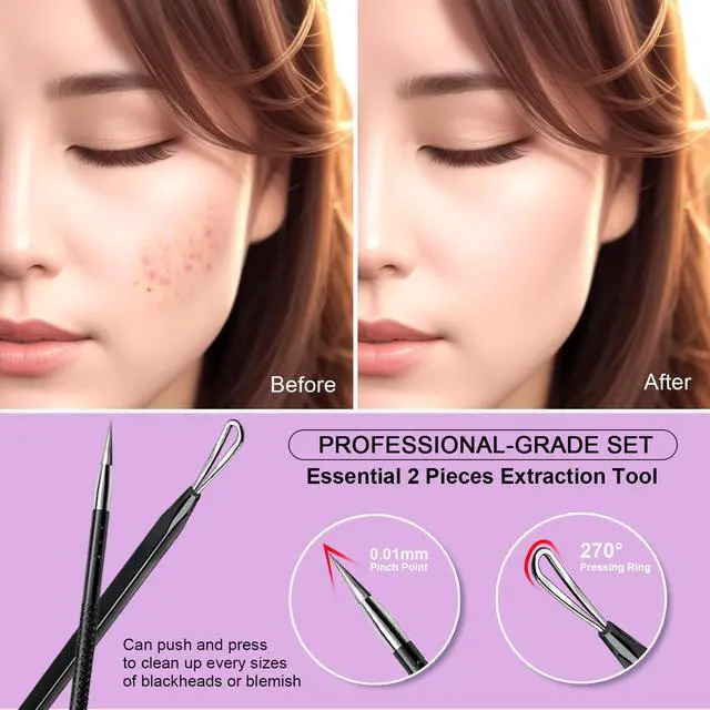 Alt view image 4 of 7 - Teenitor 2-in-1 Pimple Extractor Comedone and Acne Tool Blackhead Removal for Face and Nose Black