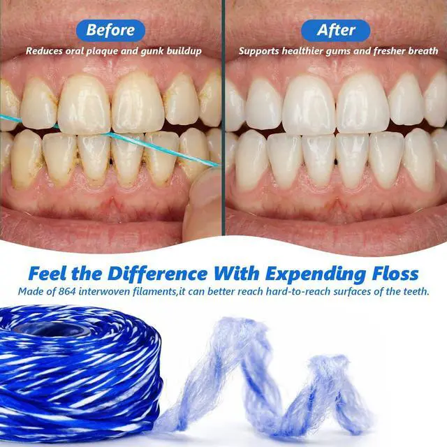 Alt view image 4 of 7 - Woven Dental Floss, Expandable Waxed Dental Floss for Gentle,Oral Care Whitening Dental Floss,Plaque Remover for Teeth,String Floss,Mint,10 Spools (32.8 yd Each)