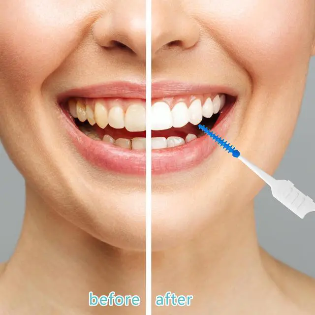 Alt view image 6 of 7 - 250 Pieces Dental Floss Picks, Silicone Interdental Brushes with Case Dental Brushes Dental Picks Blue Tooth Floss Picks for Teeth Cleaning(Blue,Green)