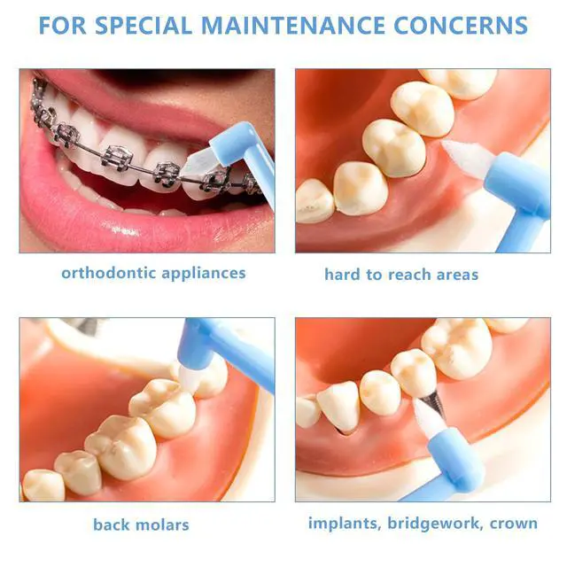 Alt view image 4 of 7 - End-Tuft Tapered Trim Toothbrush, 6 PCS Tufted Interspace Brush Wisdom Gap Toothbrush for Orthodontic Braces Bridges Line and Detail Cleaning