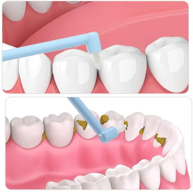 Main image of 6 Pieces End Tuft Toothbrush Single Tufted Toothbrush Soft Interdental Brushes Tooth Stain Remover for Implants Teeth Detail Cleaning Tooth Stain (Bright Colors)