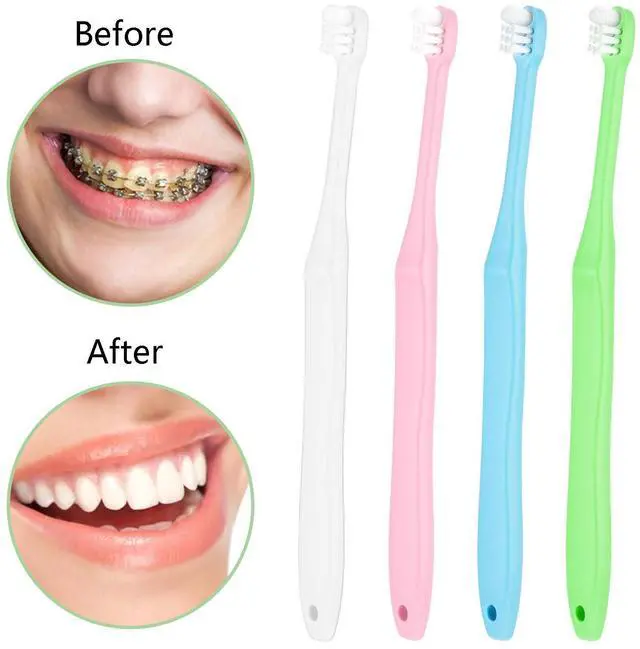 Alt view image 2 of 4 - End Tuft Toothbrush, 4PCS Nylon Soft Bristle, Small Tooth Brush for Hard-to-Reach Areas, Dental Detail Cleaning for Adults with Crowns, Bridges, Implants