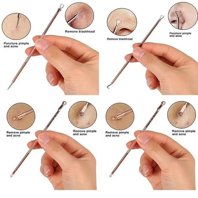 Alt view image 3 of 6 - Blackhead Remover Pimple Comedone Extractor Tool Best Acne Removal Kit - Treatment for Blemish, Whitehead Popping, Zit Removing for Risk Free Nose Face Skin with Case (Rose, 4 Piece Set)
