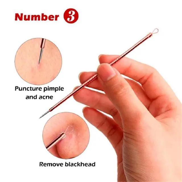 Alt view image 5 of 6 - Blackhead Remover Pimple Comedone Extractor Tool Best Acne Removal Kit - Treatment for Blemish, Whitehead Popping, Zit Removing for Risk Free Nose Face Skin with Case (Rose, 4 Piece Set)