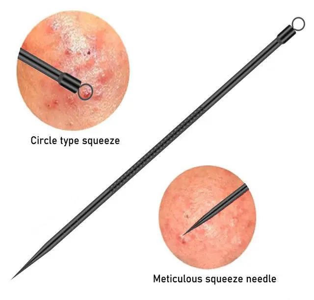 Alt view image 5 of 7 - 4-Piece Stainless Steel Blackhead Remover Pimple Popper Tool Kit for Nose and Face