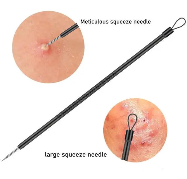 Alt view image 3 of 7 - 4-Piece Stainless Steel Blackhead Remover Pimple Popper Tool Kit for Nose and Face
