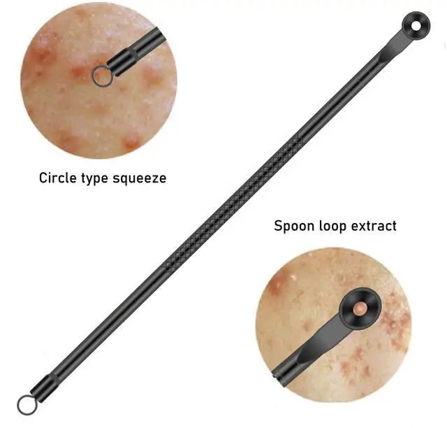 Alt view image 4 of 7 - 4-Piece Stainless Steel Blackhead Remover Pimple Popper Tool Kit for Nose and Face