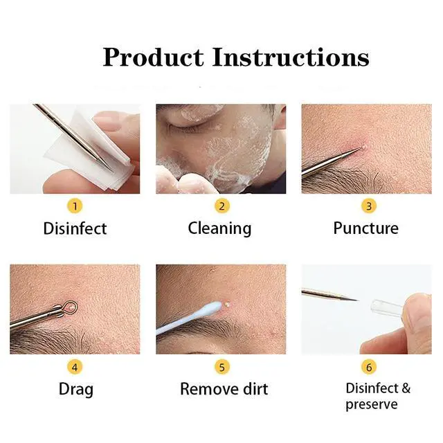 Alt view image 7 of 7 - 4-Piece Stainless Steel Blackhead Remover Pimple Popper Tool Kit for Nose and Face