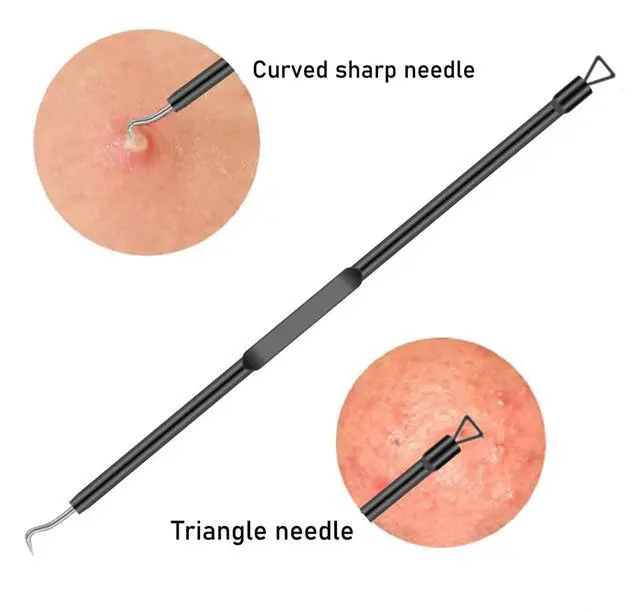 Alt view image 6 of 7 - 4-Piece Stainless Steel Blackhead Remover Pimple Popper Tool Kit for Nose and Face