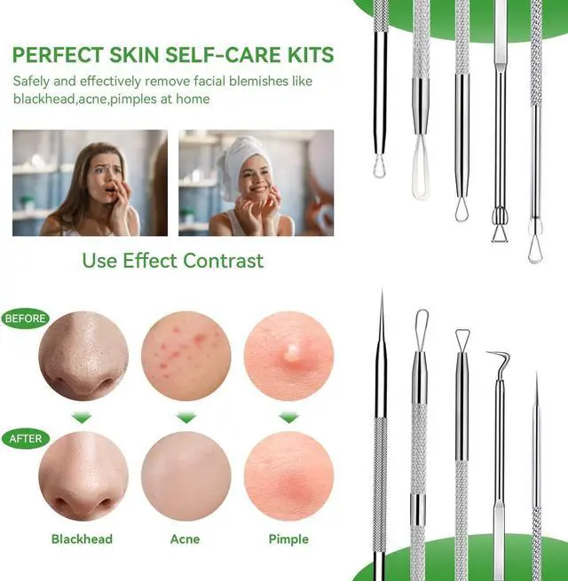 Alt view image 2 of 7 - 5 Pcs Stainless Steel Blackhead Remover Tool Kit, Pimple Popper Extractor Set for Face Acne Whitehead Comedone Zit Blemish