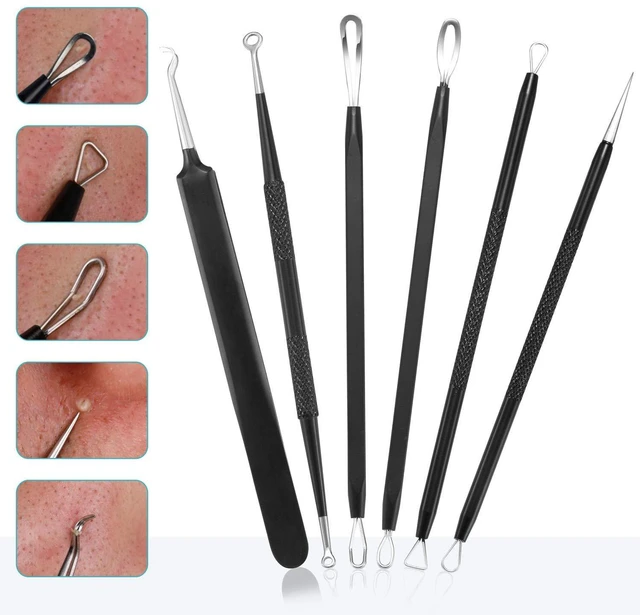 Alt view image 7 of 7 - Blackhead Remover Pimple Popper Comedone Extractor Tool Kit - 6 Piece Professional Stainless Steel