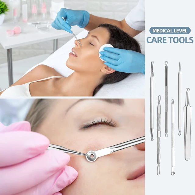 Alt view image 2 of 6 - JPNK Blackhead Remover Comedone Extractor Acne Removal Kit