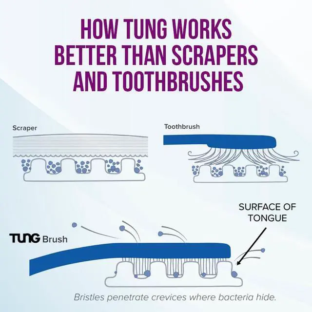 Alt view image 5 of 6 - Tung Tongue Cleaning Kit with Brush and Gel for Fresh Breath, USA Made
