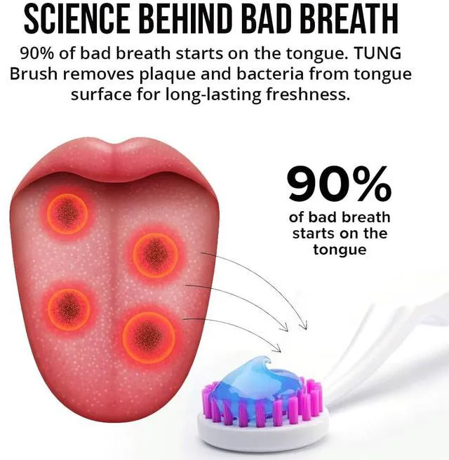 Alt view image 6 of 6 - Tung Tongue Cleaning Kit with Brush and Gel for Fresh Breath, USA Made