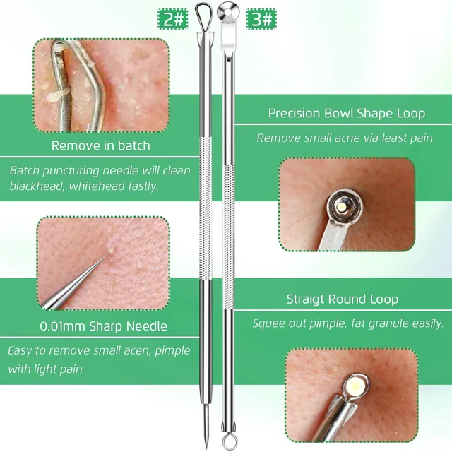 Alt view image 6 of 7 - 5Pcs Stainless Steel Blackhead Remover Comedone Extractor, Curved Tweezers Kit, Professional Acne Blemish Removal Tools