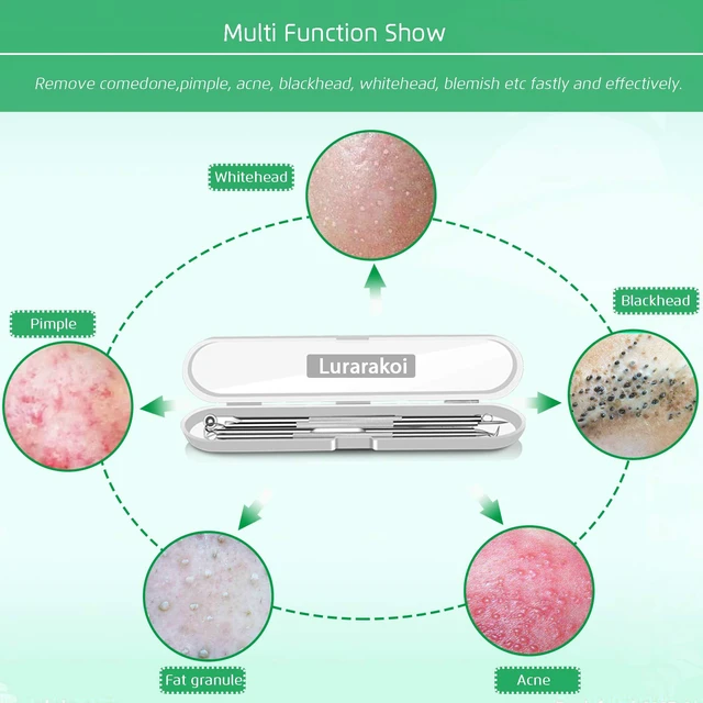 Alt view image 2 of 7 - 5Pcs Stainless Steel Blackhead Remover Comedone Extractor, Curved Tweezers Kit, Professional Acne Blemish Removal Tools