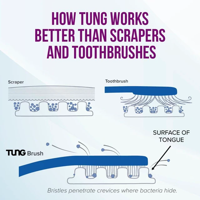 Alt view image 6 of 6 - Tung Tongue Cleaning Kit with Brush & Gel for Fresh Breath, USA Made