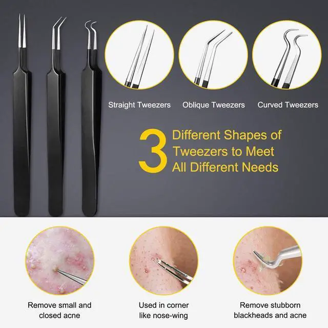 Alt view image 4 of 7 - Pimple Popper Tool Kit - Boxoyx 10 Pcs Blackhead Remover Comedone Extractor Kit with Box for Quick and Easy Removal of Pimples, Blackheads, Zit Removing, Forehead,Facial and Nose (Black)