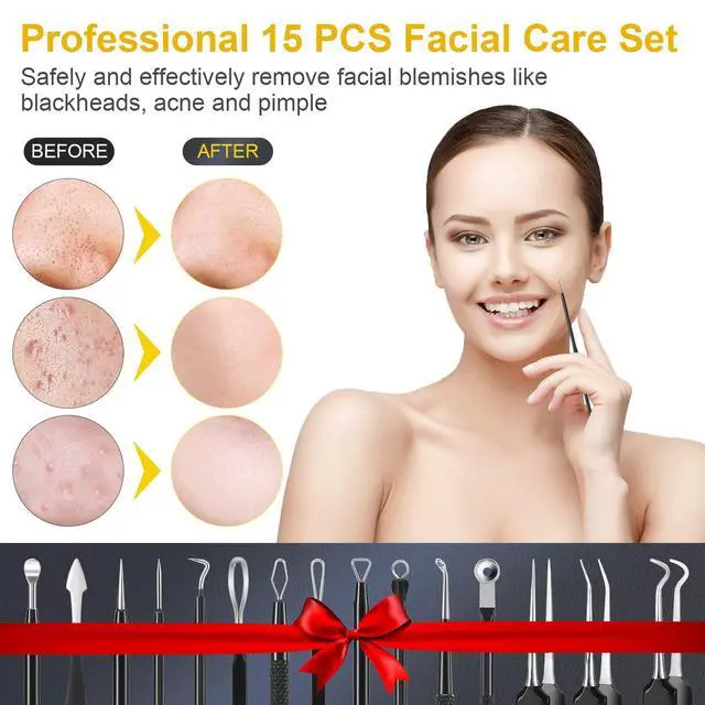 Alt view image 5 of 7 - Pimple Popper Tool Kit, IUMAKEVP 15 PCS Professional Stainless Steel Blackhead Remover Comedone Extractor Tools for Removing Pimples, Blackheads, Zit on Face - Acne Removal Kit with Metal Case (Black)