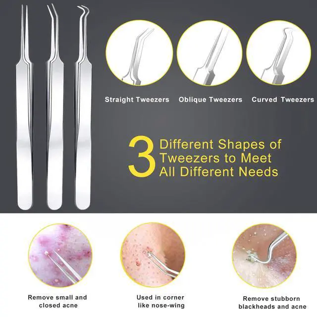 Alt view image 4 of 7 - Pimple Popper Tool Kit - Boxoyx 10 Pcs Blackhead Remover Comedone Extractor Kit with Metal Case for Quick and Easy Removal of Pimples, Blackheads, Zit Removing, Forehead,Facial and Nose(All Silver)