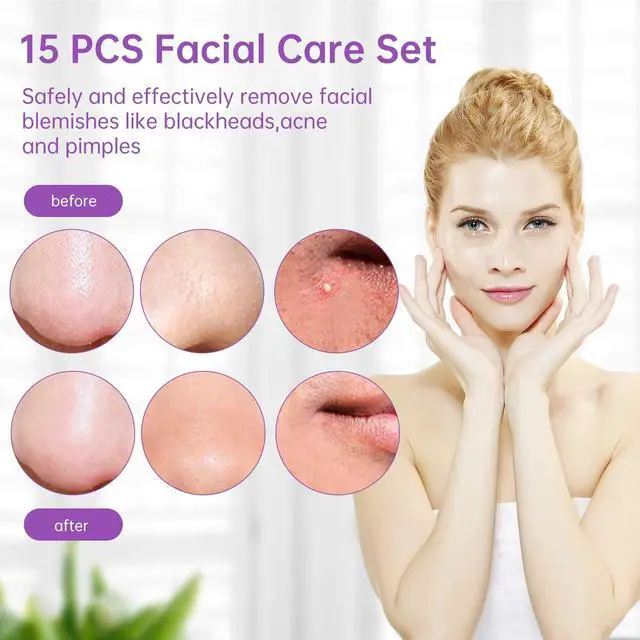Alt view image 6 of 7 - 15 PCS Pimple Popper Tool Kit,Blackhead Remover Comedone Extractor Tools,Professional Pimple Comedone Extractor,Stainless Steel Skin Blemish Removal Acne Tools for Forehead Nose Face with Metal Case