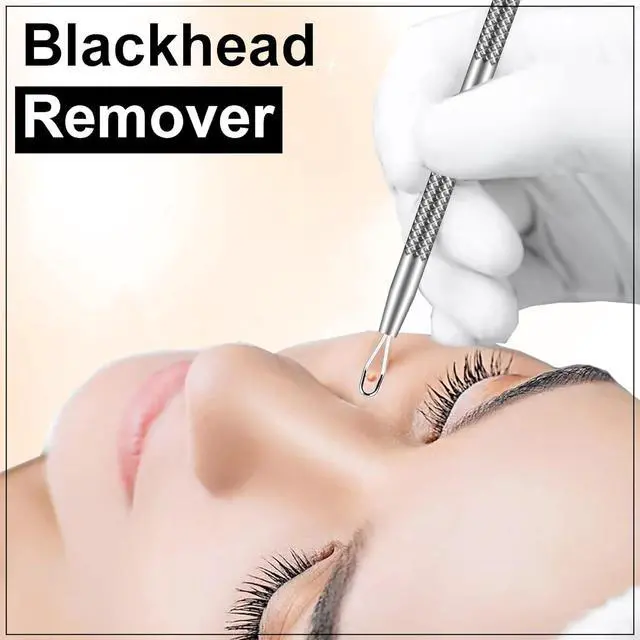 Alt view image 3 of 7 - Blackhead Remover Kit with Stainless Steel Tools, Pimple Extractor, Acne Removal & Facial Cleansing Tools for Men & Women