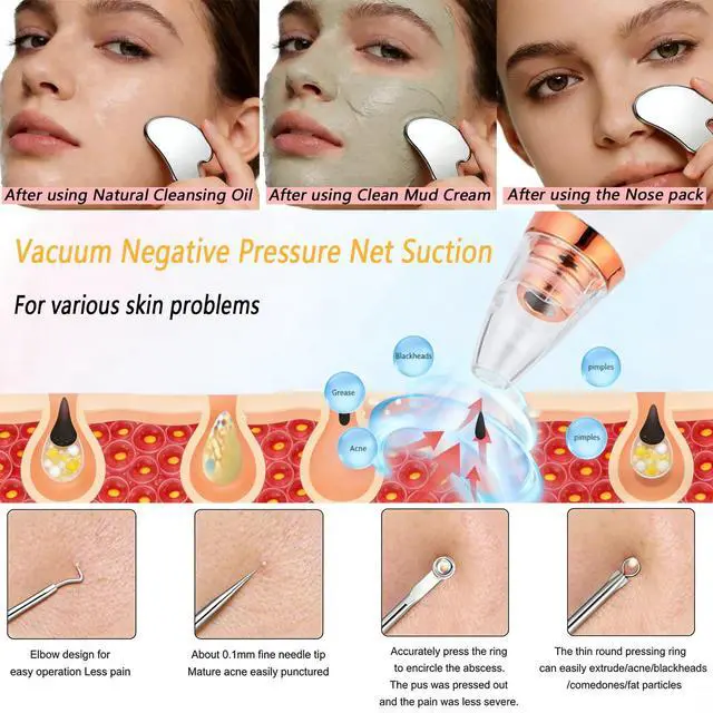 Alt view image 2 of 7 - Blackhead Remover Vacuum, Black Head Remover for Face, Blackhead Extractor with 3 Suction Power, 6 Suction Probes, 4 pcs Pimple Popper Tool Kit, USB Interface Type Pore Vacuum