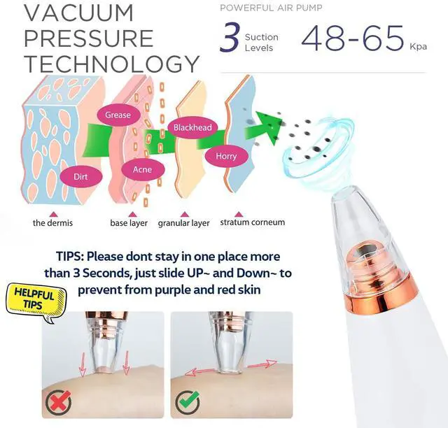 Alt view image 3 of 7 - Blackhead Remover Vacuum, Black Head Remover for Face, Blackhead Extractor with 3 Suction Power, 6 Suction Probes, 4 pcs Pimple Popper Tool Kit, USB Interface Type Pore Vacuum