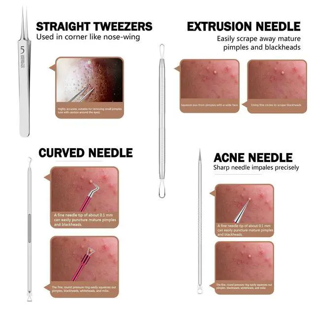Alt view image 6 of 7 - Blackhead Remover Pimple Popper Tool Kit 10 Pcs Blackhead Remover Tools Kit with Storage Case Pimple Popper Tool kit for Face Nose Deep Cleansing Pimple Extractor for Quick and Easy Removal of Pimples