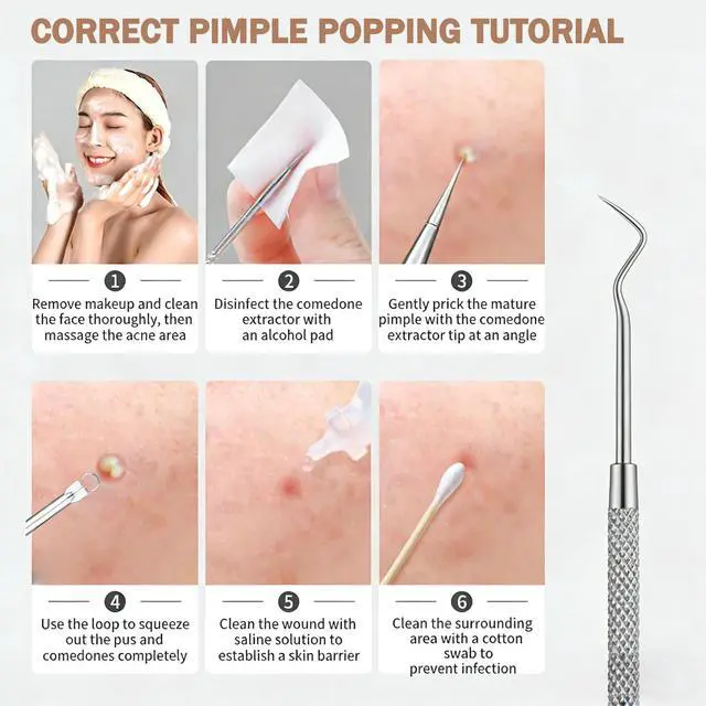 Alt view image 5 of 7 - Blackhead Remover Pimple Popper Tool Kit 10 Pcs Blackhead Remover Tools Kit with Storage Case Pimple Popper Tool kit for Face Nose Deep Cleansing Pimple Extractor for Quick and Easy Removal of Pimples