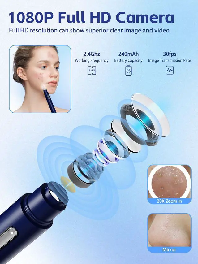Alt view image 2 of 7 - Visual Blackhead Remover Tools with Camera,Pimple Popper Extractor Tool Kit with Camera 20X 1080P Pore Cleaner Acne Comedone Whitehead Extractor Kit for iPhone/Android (Blue)