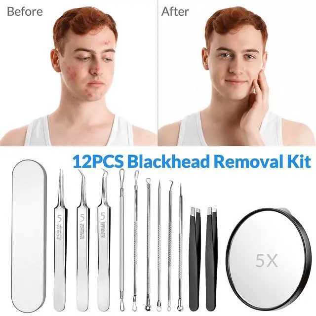 Alt view image 5 of 6 - Pimple Popper Tool Kit 12PCS: 9 × Blackhead Removers, 2 ×Eyebrow Tweezers, 1 × 5X Mirror, Stainless Pimple Extractor, Blackhead, Acne, Blemish, Facial Hair Removal Tools Kit (Black)