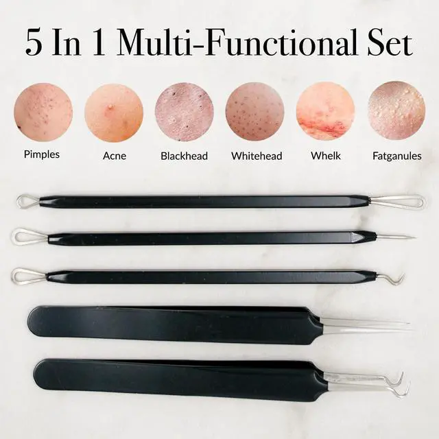 Alt view image 3 of 7 - Acne & Blackhead Remover Skin Care Tool Set for Men & Women - 5 Piece Pimple Popper Kit + Mirror! | Removal of Whiteheads, Zits, Black Heads, Comedone Extractor | As Seen on Shark Tank