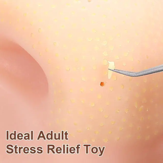 Alt view image 4 of 6 - Pimple Popper Toy Stress Relief Zit Popping Toy Squeeze Nose Blackhead Remover Simulator with Tweezers for Adults only Novelty Fun