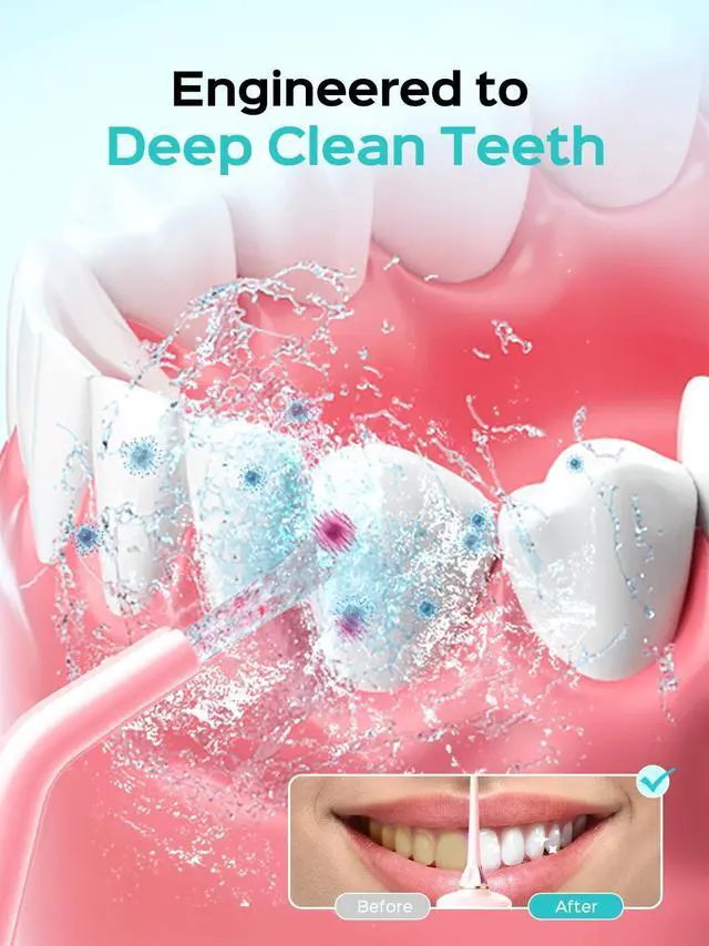 Alt view image 2 of 7 - E40 Portable Water Flosser for Teeth: ADA Accepted, 10 Pressure Settings Professional Water Dental Pick for Orthodontic, Braces & Sensitive Gums - Cordless for Travel Use, for Teens, BPA-Free