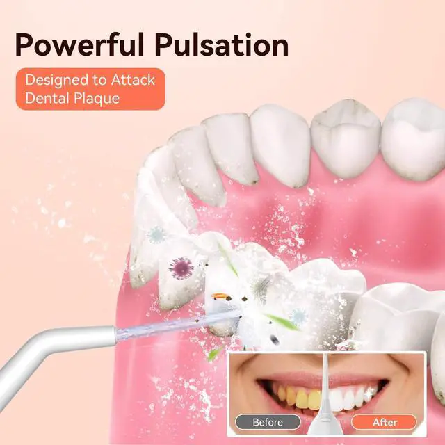 Alt view image 3 of 7 - Cordless Portable Water Flosser with 300ML Tank: Rechargeable Oral Irrigator with 5 Tips for Travel, Braces Care and Sensitive Gums, IPX7 Waterproof Teeth Cleaning Device(Pink)