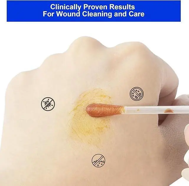 Alt view image 5 of 7 - Povidone Iodine Swabsticks, 100 Count, Individually Wrapped with Snap-Release Solution, Skin Prep Swabs for First Aid Kits, Wound Care & Travel with PP Storage Case