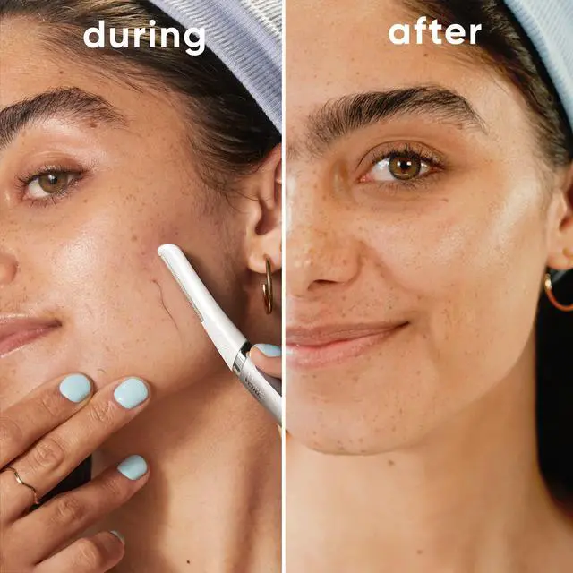 Alt view image 5 of 7 - Dermaplaning Tool, 2 Blade Refills, Exfoliating Face Razors for Women, Eyebrow and Facial Dermaplane Razor