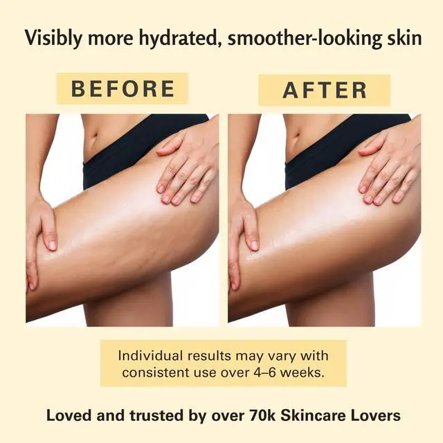 Alt view image 7 of 7 - Firming Body Massage Oil with Collagen & Stem Cell Helps Smooth the Appearance of Cellulite & Improve Skin Texture Refreshing Aromatherapy Body Oil for Legs & Full Body 8 Fl Oz by M3