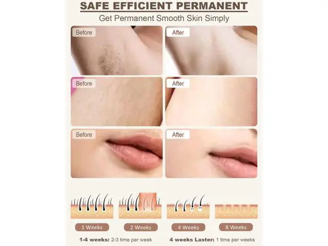 Alt view image 5 of 7 - BONAEVER Laser Hair Removal for Women Permanent Painless at-Home IPL Hair Removal Device Upgraded to 999999 Flashes 5 Level Energy Adjustable & 6 Flash Modes