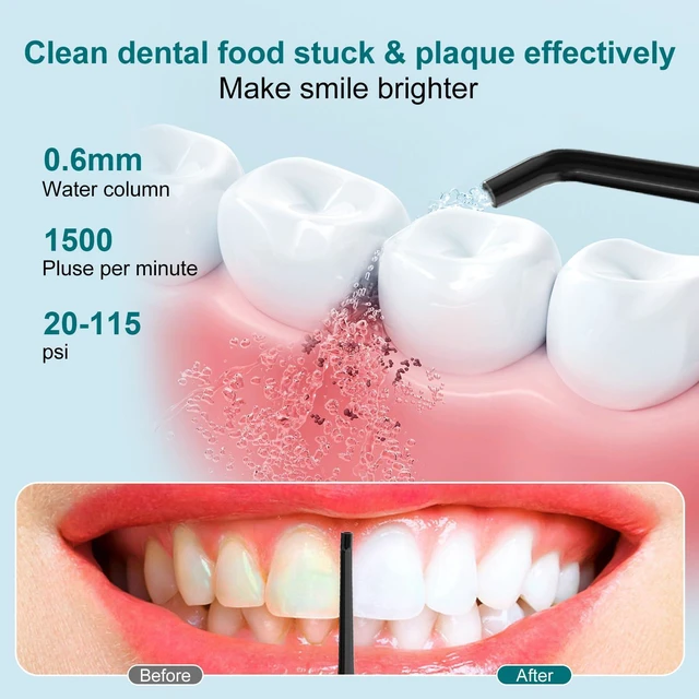 Alt view image 2 of 7 - Water Dental Flosser Teeth Pick - Fast Charge Cordless Teeth Cleaner, 3 Modes Portable Oral Irrigator, IPX7 Waterproof Electric Water Dental Flosser for Tonsil Stone, 300ML Tank