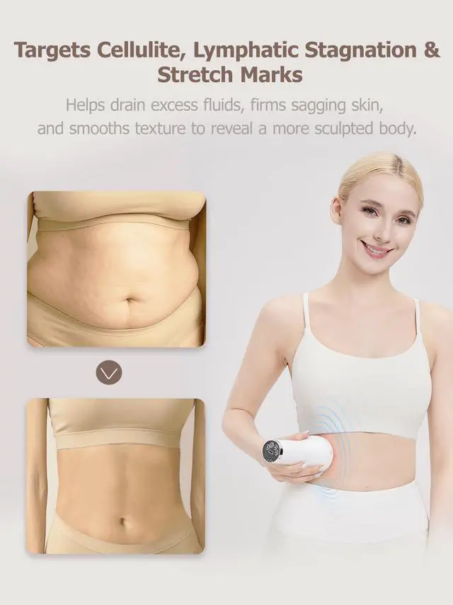 Alt view image 7 of 8 - Lymphatic Drainage Massager & Anti Cellulite Massage Tool, for Legs, Arms & Belly, Body,Helps Reduce Stretch Marks & Cellulite,with Microcurrent, Light Heat & Vibration