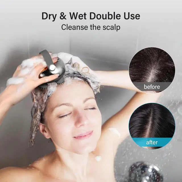 Alt view image 3 of 7 - Scalp Massager Rechargeable Head Massager Scalp Stress Relax, Waterproof Handheld Hair Scratcher with 8 Removable Massage Claws, Gift for Dad Mom