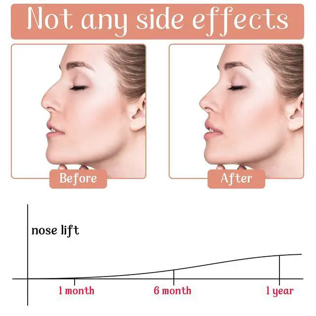 Alt view image 3 of 6 - 6 Pairs Nose Up Lifting Shaping Clip Beauty Tool Nose Shaper Inserts No Pain Invisible Nose Shaper Tool Straightening Beauty Kit for Women Men (Black)