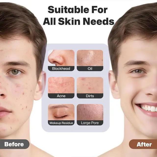 Alt view image 5 of 7 - Facial Cleansing Brush, Rechargeable Silicone Face Scrubber with Heat Massage End, Vibrating Exfoliator Scrubber for Deep Cleaning, Waterproof Face Brush for Women and Men (Black)