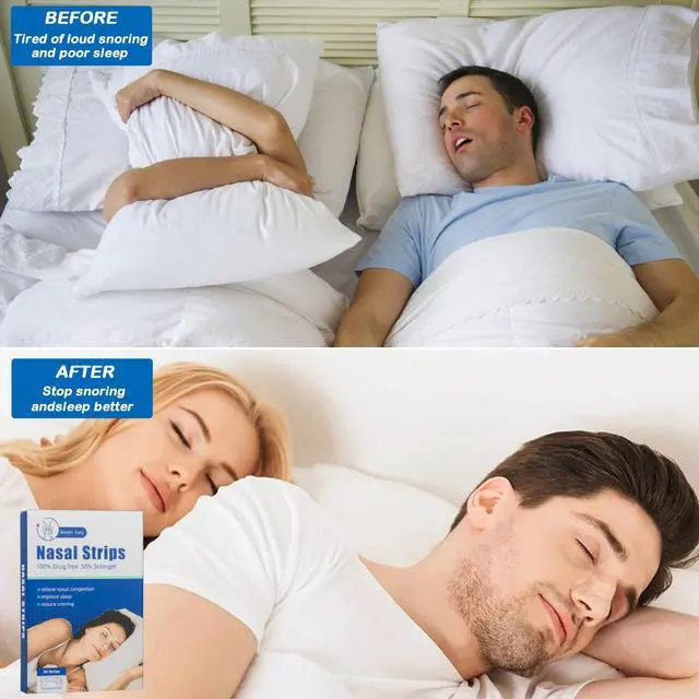 Alt view image 4 of 6 - Anti-Snoring Devices Nasal-Strips for Breathing Nasal Congestion Relieve (30 Count)
