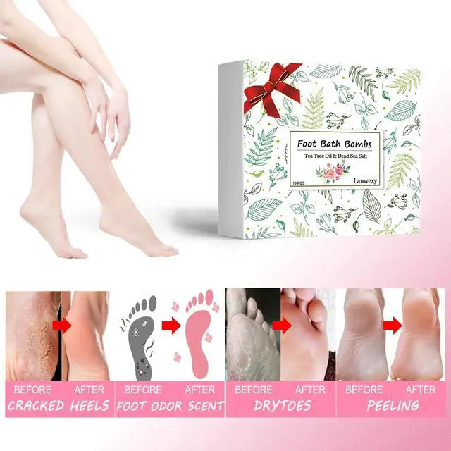 Alt view image 2 of 7 - Bath Foot Bombs, 16 Pack Foot Soak with Bath Salt and Tea Tree Oil for Christmas. Organic Natural Handmade Aroma Pure Essential Oil Bubble Feet Balls for Foot Callus, Stubborn Feet Odor Scent.