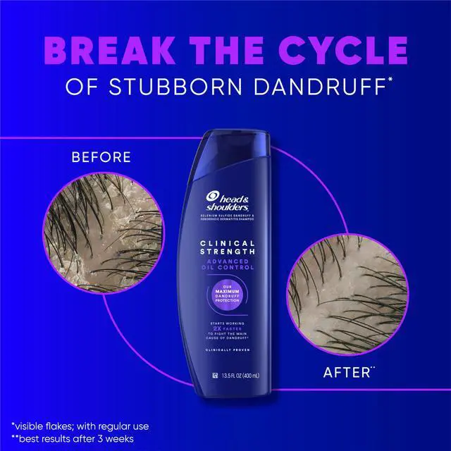 Alt view image 4 of 7 - Anti-Dandruff Shampoo with 1% Selenium Sulfide, Clinical Strength Advanced Oil Control Twin Pack, Seborrheic Dermatitis Relief, Oily Scalp, 13.5 Fl Oz Each