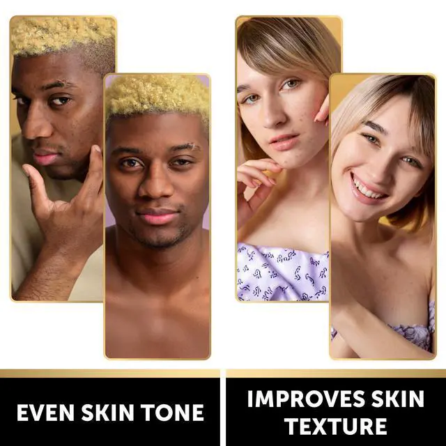 Alt view image 2 of 7 - Kojic Acid Soap - Turmeric Soap for Dark Spots for Face and Body - Exfoliating Bar for Hyperpigmentation, Skin Tone Corrector with Retinol, Vitamin C, Collagen and Hyaluronic Acid - 1 Pack
