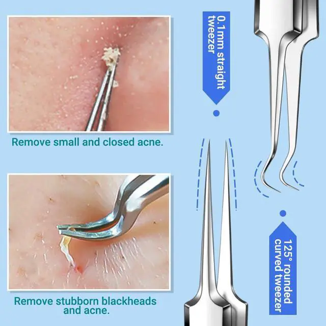 Alt view image 3 of 7 - Blackhead Remover Pimple Extractor Acne Treatment Tool, Comedones Removal Kit for Blemish, Whiteheads, 9 pcs Pimple Popper Tool Kit for Facial and Nose